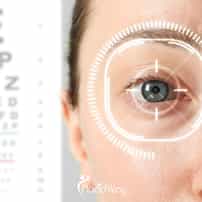 LASIK-Augenoperation in der Türkei: Das beliebte Verfahren zur Sehkorrektur bei deutschen Patienten